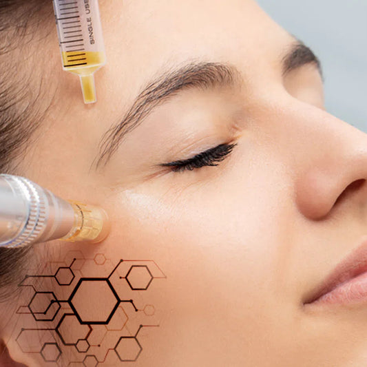 EXOSOMAS CON MICROAGUJAS + PEELING