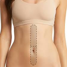 MEDIA LINEA ABDOMINAL